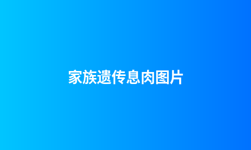 家族遗传息肉图片
