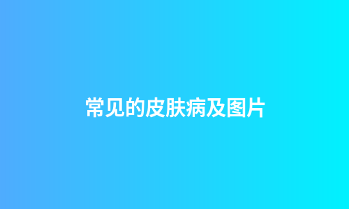 常见的皮肤病及图片