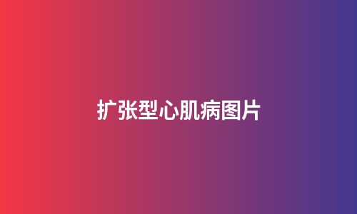 扩张型心肌病图片