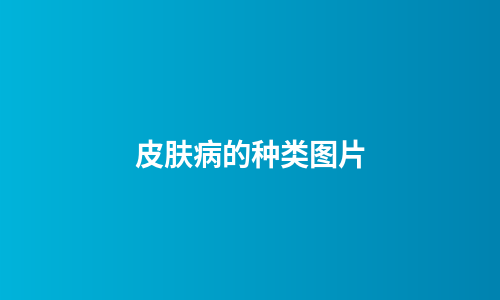 皮肤病的种类图片