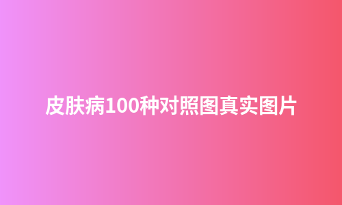 皮肤病100种对照图真实图片
