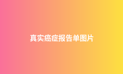 真实癌症报告单图片