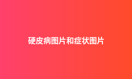 硬皮病图片和症状图片