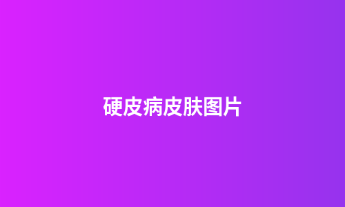 硬皮病皮肤图片