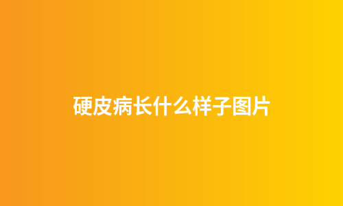 硬皮病长什么样子图片