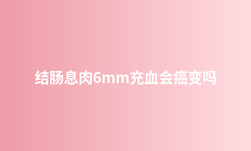 结肠息肉6mm充血会癌变吗