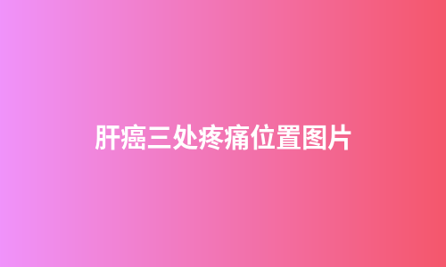 肝癌三处疼痛位置图片