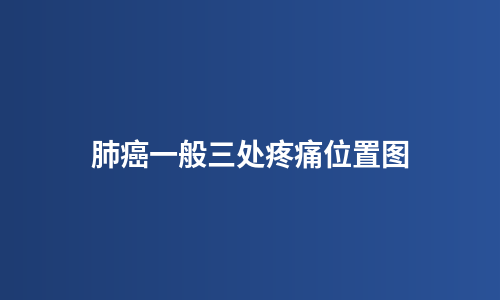 肺癌一般三处疼痛位置图