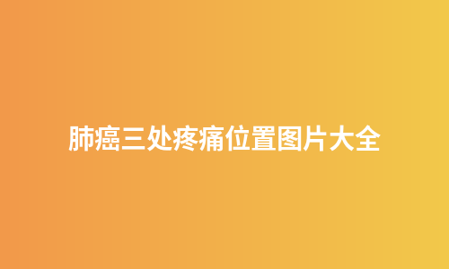 肺癌三处疼痛位置图片大全