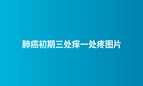 肺癌初期三处痒一处疼图片