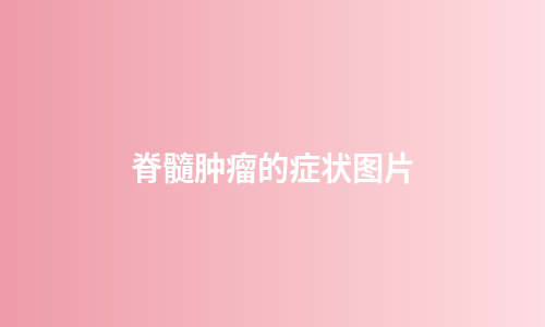 脊髓肿瘤的症状图片