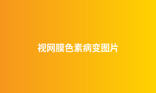视网膜色素病变图片