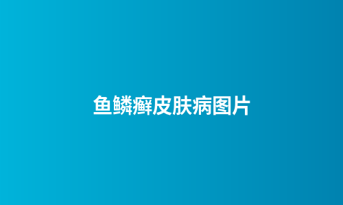 鱼鳞癣皮肤病图片