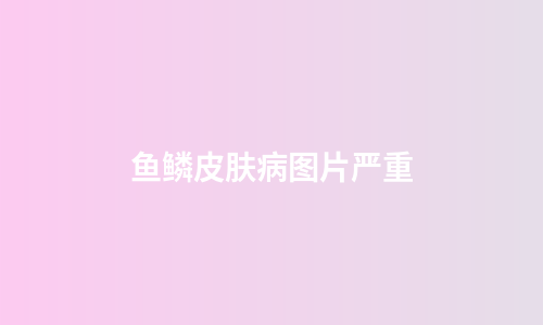 鱼鳞皮肤病图片严重