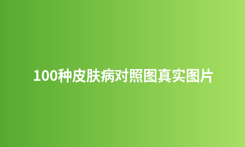 100种皮肤病对照图真实图片