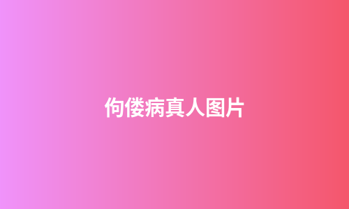 佝偻病真人图片