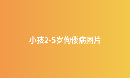 小孩2-5岁佝偻病图片