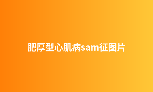 肥厚型心肌病sam征图片
